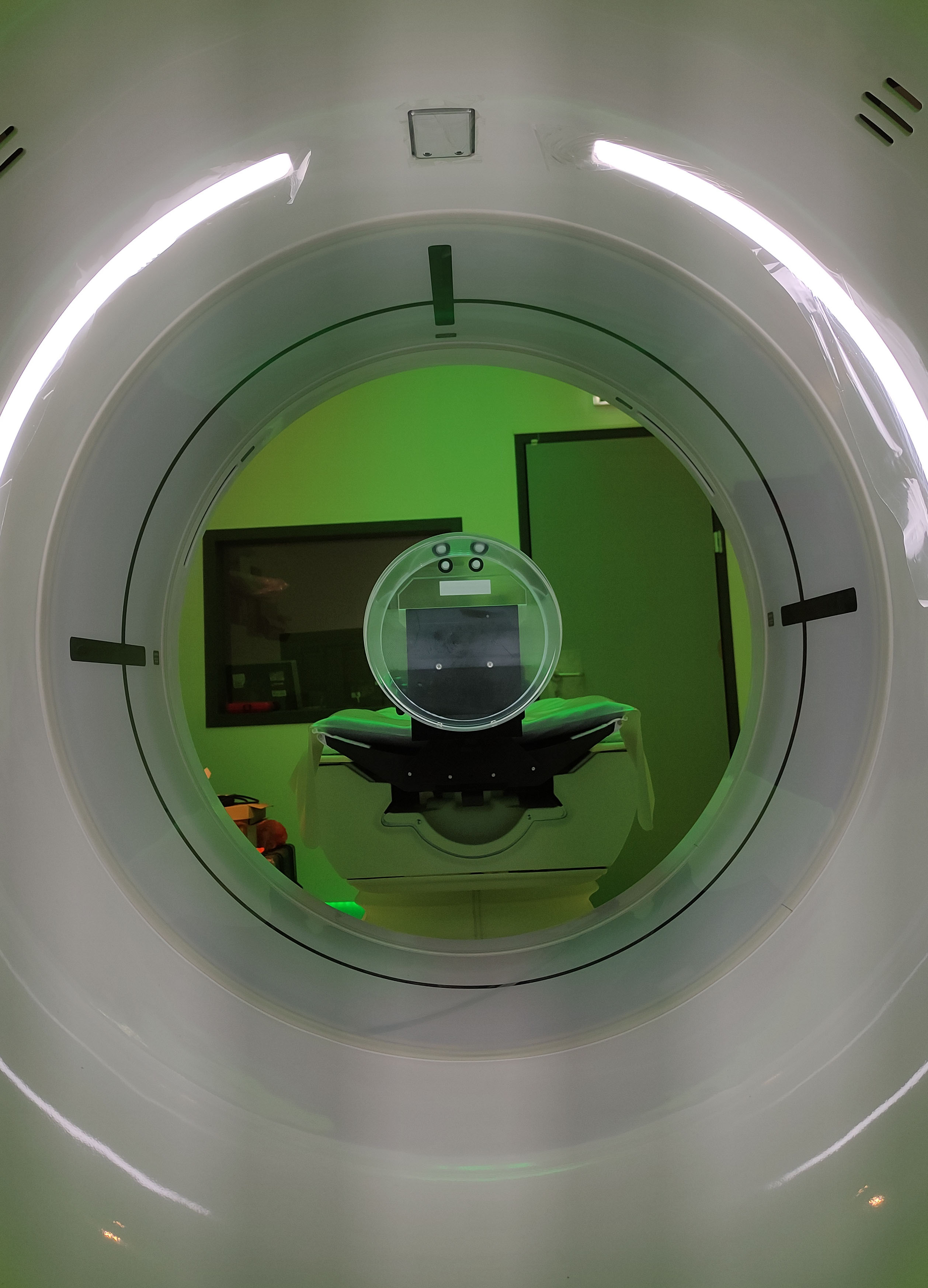 CT Scan Revolution